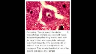 Lab or Diagnostic Findings: Negri bodies of Rabies (Lyssavirus)