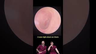 40 Years Without Wax Removal Leads to Major Hearing Issues!
