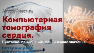 Компьютерная томография сердца