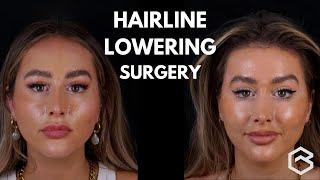 What is Halo Surgery? | Dr Greg Bran