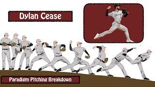 Dylan Cease Pitching Mechanics Breakdown | Learn Key Principles of Efficient Pitching Mechanics