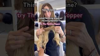 Comment “Hairline Topper” if you want the link#hairtopper #thinninghair #recedinghairline #toppers