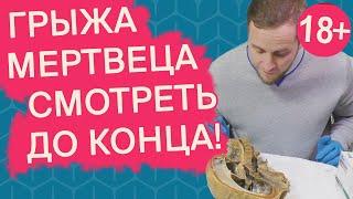 Грыжа у ТРУПА | Может ли массажист ПРОДАВИТЬ ГРЫЖУ? | Доктор Епифанов