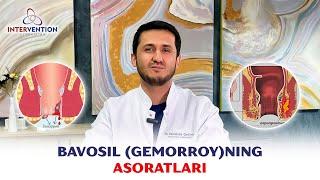 Bavosil (gemorroy)ning asoratlari