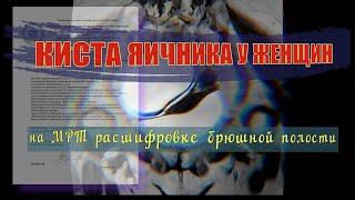 Параовариальная КИСТА ЯИЧНИКА у женщин и хронический ПАНКРЕАТИТ на РАСШИФРОВКЕ МРТ брюшной полости