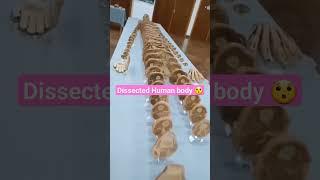 Dissected Human body  #mbbs #medico #students #doctor #study #hostellife #kota #medicalcollege