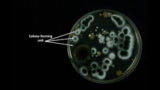 How to calculate Colony Forming Units (CFU)