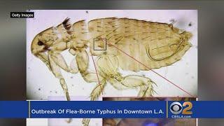 Downtown LA Hit With Outbreak Of Flea-Borne Typhus