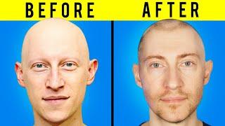 How I Got My Hair Back...