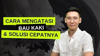 Cara mengatasi Bau kaki & Solusi cepatnya