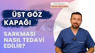 Üst Göz Kapağı Sarkması ( Göz Kapağında Düşme) Nasıl Düzeltilir? Ameliyat mı? Lazer mi?