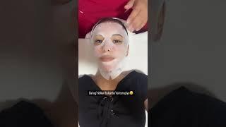 karboksi terapiya yuzni qon aylanishini yaxshilaydi  Instagram @cosmetolog_diyana