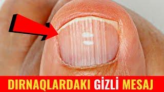 DİQQƏT! Dırnaqlarınız Xəstəliklərdən Xəbər Verir! - Bu Əlamətlər Varsa...