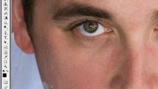 Portrait Makeover Part  2 - Removing Pimples & Wrinkles