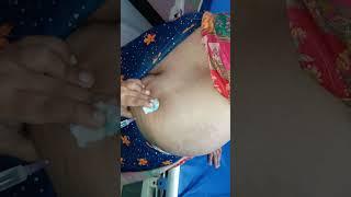 new injection vlog girl | dr divya vlog injection | hip injection Indian video| im injection video