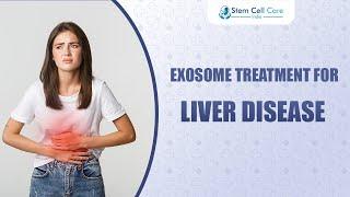 Revolutionary Exosome Therapy for Liver Regeneration – What You Need to Know | Stem Cells |