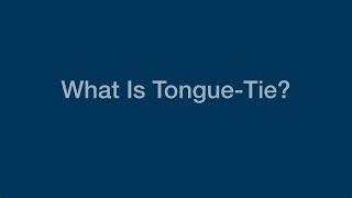 What is Tongue Tie?