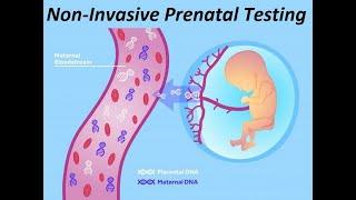 NIPD test: генетический тест по беременности Trisomy 13, 18 и 21