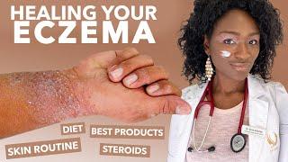 How to Treat ECZEMA-Atopic Dermatitis: Black Dark Skin, Dry Flaky Skincare Routine Hyperpigmentation