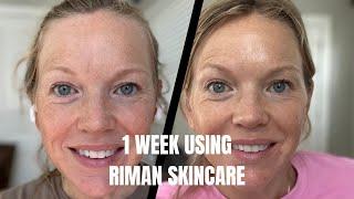 1 Week Using Riman Skincare (Expert Ritual) Before and After