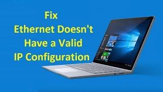 Ethernet Doesn't Have a Valid IP Configuration!! - Howtosolveit