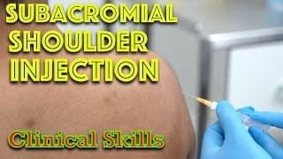 Shoulder Injection Without Ultrasound - Steroid Injection Consent - Clinical Skills - Dr Gill