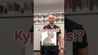 Kyphosis / Bad Posture? Try and share! #shorts #kyphosis #posture #tips #viral #fyp