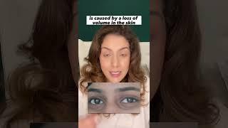 Listen if you have under eye hollowness #shortsvideo #skincare #skincaretips