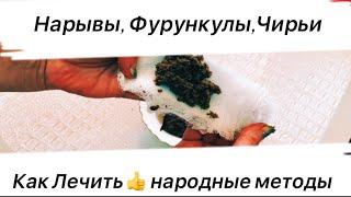 ЗНАХАРСКИЙ РЕЦЕПТ для Лечения ФУРУНКУЛОВ (ЧИРИЯ) за Одну НочьЛичный Опыт!!!Поможет Всем 100%!!!!