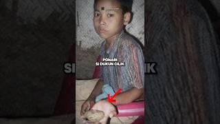 Dukun Cilik Yang Punya "Batu Sakti" Penyembuh Penyakit : Ponari #lethologicaman