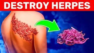 #1 Natural Remedy to Destroy the Herpes Virus