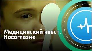 Медицинский квест. Косоглазие | Телеканал «Доктор»