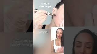  Discover the secrets to a younger-looking you! #microneedling #beauty #skin #skincare