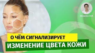 О чем сигнализирует изменение цвета кожи? [Шишова О.И.]