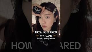 HOW I CLEARED MY ACNE AND SKIN AT HOME :) very requested vid #glowup #skincareroutine #glowuptips