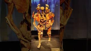 Body Worlds is a traveling exposition of dissected human bodies and other anatomical structures...