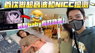 首次做baby screening和NICC检测～看到baby在打功夫！兴奋！好神奇的感觉！