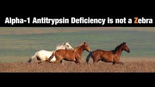 Alpha-1 Antitrypsin Deficiency is Not a Zebra -- BAVLS