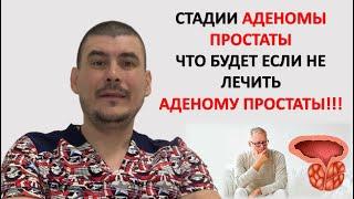 СТАДИИ АДЕНОМЫ ПРОСТАТЫ. ЧТО БУДЕТ ЕСЛИ НЕ ЛЕЧИТЬ АДЕНОМУ ПРОСТАТЫ!!!