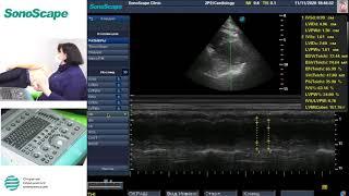 Мастер-класс на аппарате SonoScape S8Exp. Лектор: Рыбакова М.К.