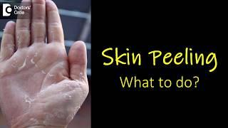 What causes skin peeling from fingers and feet? How to manage? - Dr. Rasya Dixit