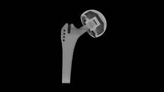 Which hip replacement?