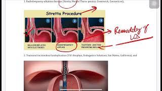 GERD , STRETTA/LINX/MUSE ,FUNDOPLICATION