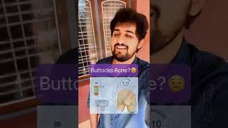 Buttocks Acne Remedies #drniranjansamani #viral #youtubeindia #youtubeshorts #foryou #explore