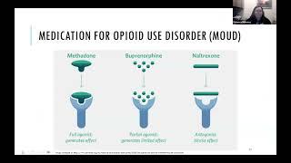 "Evolving Induction Strategies for the Treatment of Opioid Use Disorder" - Rebecca Maloney, 01/03/25
