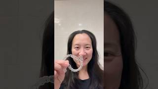 4th week on Invisalign #invisalign