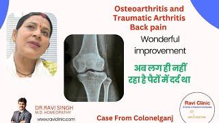 Osteoarthritis and Sciatica Getting Cured