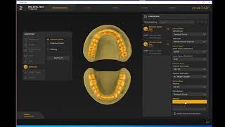 How to Import STL files to inLab CAD 22