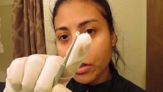 BACK‼️ w/ ASMR Facial Extraction AND a THANK YOU 