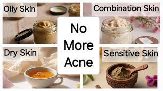 Pimples removal on face at home/tan removal home remedies/glowing skin home remedy